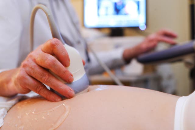 UK is one of few European countries not to offer a late-term ultrasound scan 