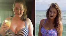 Instagram deleted this woman’s weight loss photo for no reason