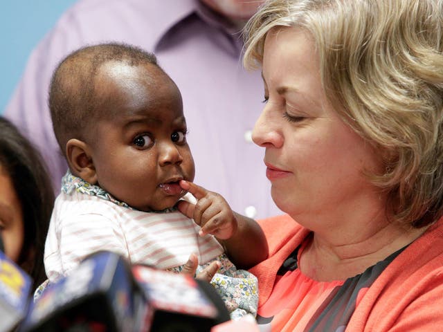 Foster mother Nancy Swabb holds Dominique, a 10-month-old baby born with two spines and an extra set of legs protruding from her neck