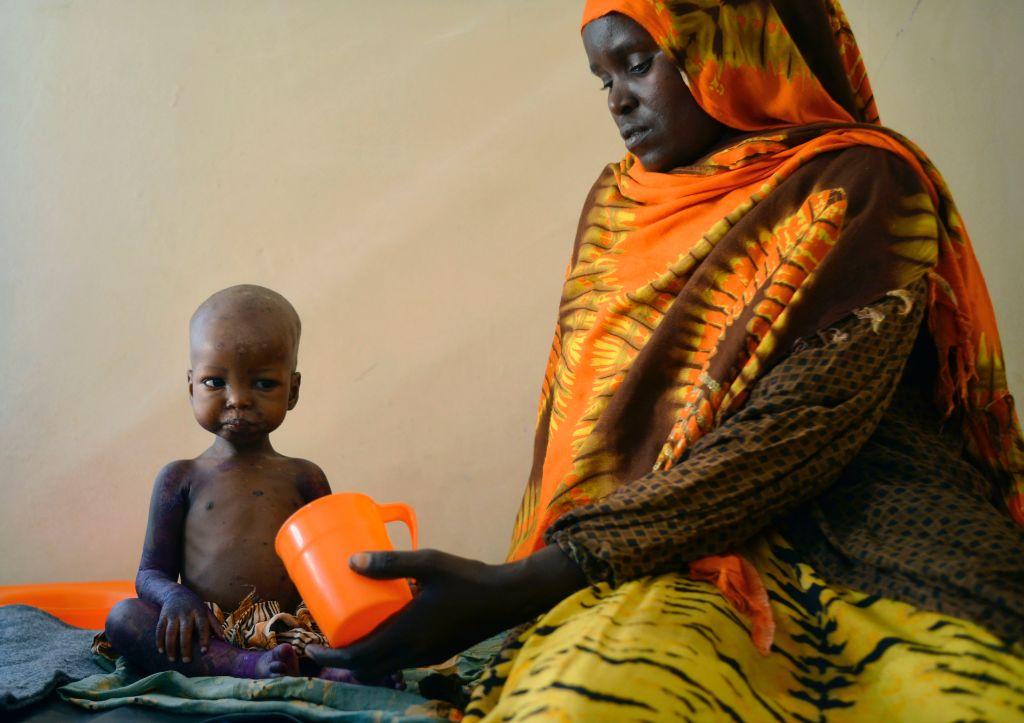 A child is fed a special formula by her mother at a hospital in Baidoa, Somalia, where drought is causing severe malnourishment