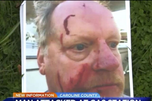 The man, identified as Bob, was attacked with a hammer while driving home to Massachusetts with his boat