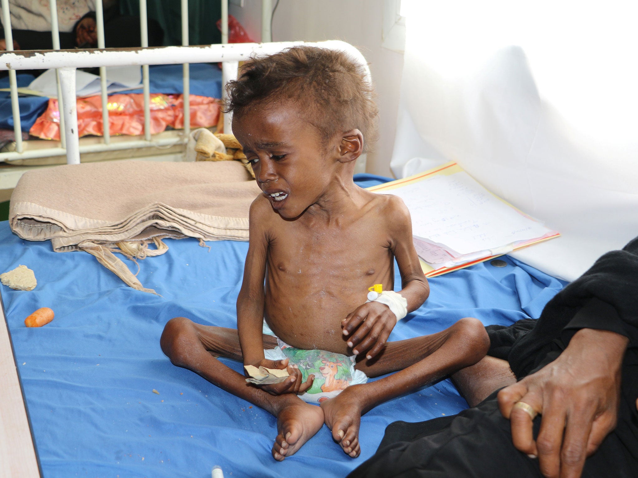 As many as 460,000 children face severe malnutrition in Yemen and 70 per cent of the population struggle to feed themselves