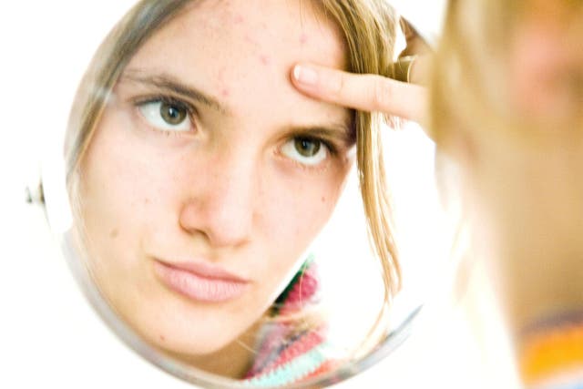 There is no known cure for acne 