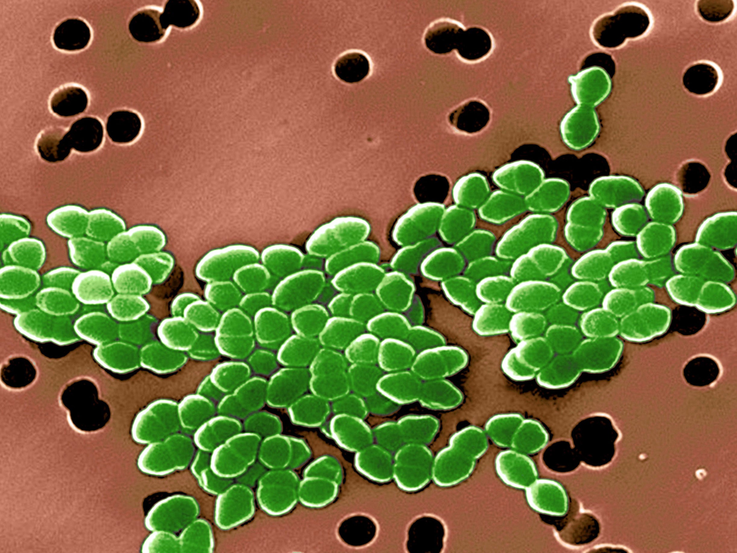 Color enhanced scanning electron micrograph of Vancomycin Resistant Enterococci (VRE). This strain of enterococcus bacteria is resistant to the antibiotic vancomycin. Common infections caused by enterococci are urinary tract inections and wound infections.