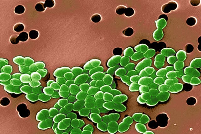 Color enhanced scanning electron micrograph of Vancomycin Resistant Enterococci (VRE). This strain of enterococcus bacteria is resistant to the antibiotic vancomycin. Common infections caused by enterococci are urinary tract inections and wound infections.