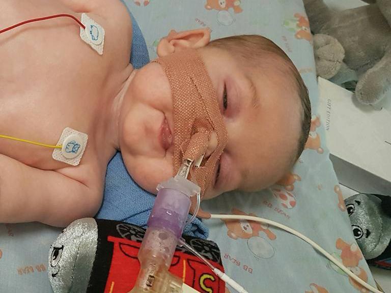 Eight-month-old Charlie Gard has a form of mitochondrial disease and is ventilator-dependent (Facebook/Charliegardsfight)