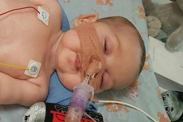 Eleven-month-old Charlie Gard has a form of mitochondrial disease and is ventilator-dependent