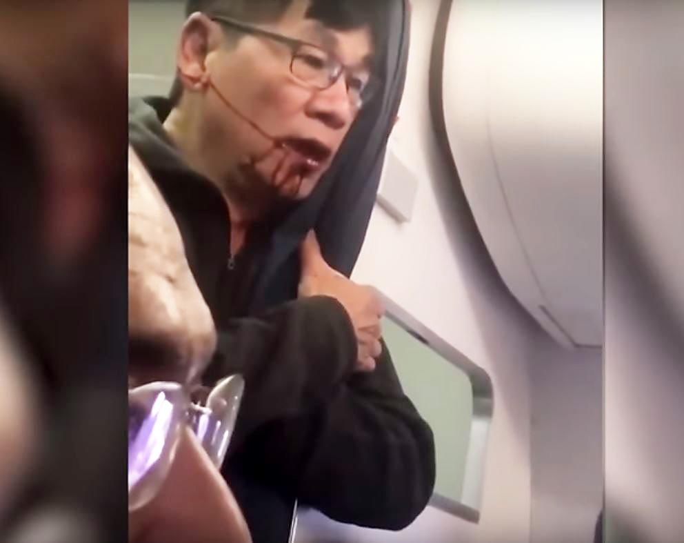 David Dao is a lesson to airlines everywhere (YouTube)