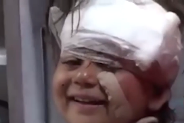 A Syrian injured in a bus bomb attack smiles at the camera