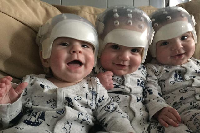 Jackson, Hunter, and Kaden Howard were all born with a rare skull disorder and underwent surgery at just 11 weeks old  
