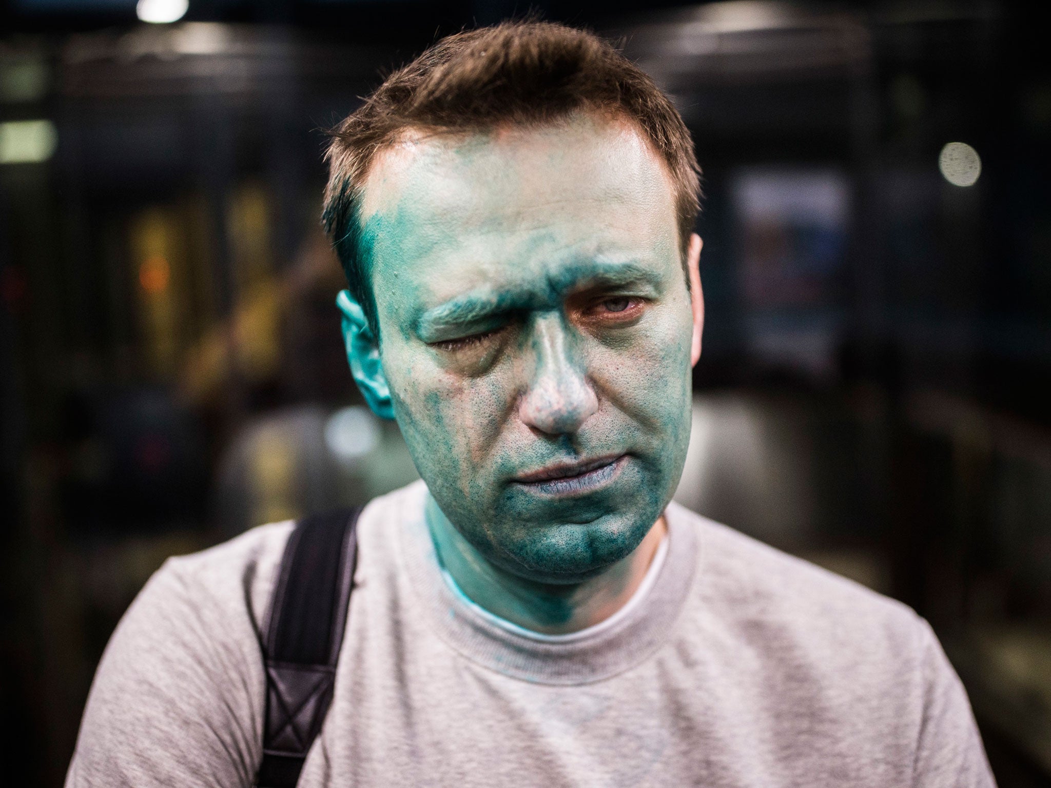 Russian opposition leader Alexei Navalny poses for a photo after unknown attackers doused him with green liquid