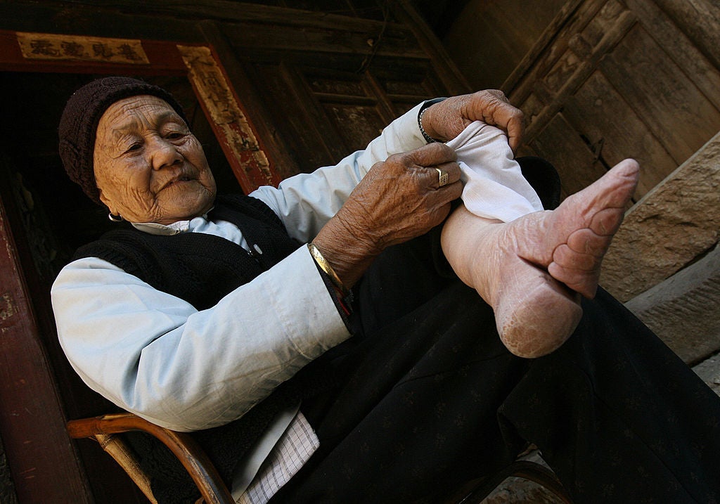 Zhou Guizhen who is 86 years old, shows one of her bound feet where the bones in the four small toes were broken and forced underneath the foot over a period of time, at her home in Liuyi village in China's southern Yunnan Province