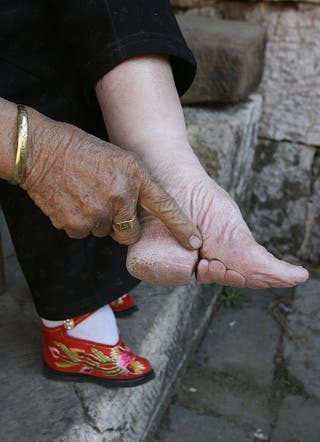 Graphic photos show brutal reality of ancient Chinese practice of foot