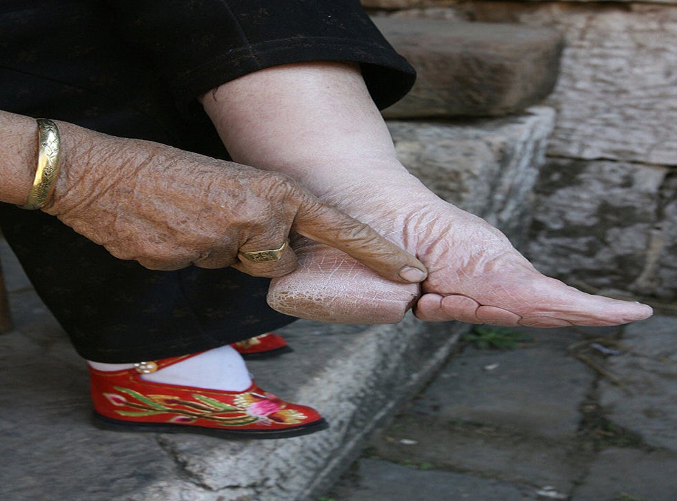 Graphic Photos Show Brutal Reality Of Ancient Chinese Practice Of Foot Binding The Independent The Independent