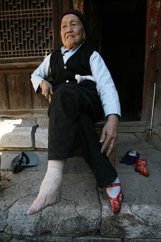 Graphic photos show brutal reality of ancient Chinese practice of foot