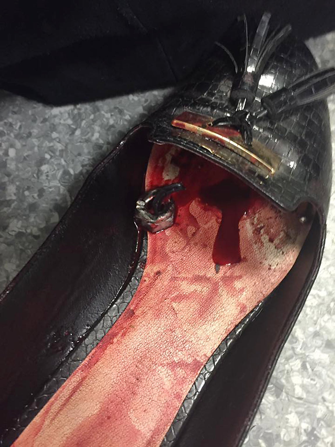 A bloody shoe with a piece of shrapnel in it