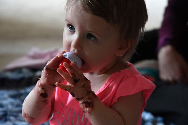 Baby Elizabeth’s epidermolysis bullosa is caused by a rare genetic fluke