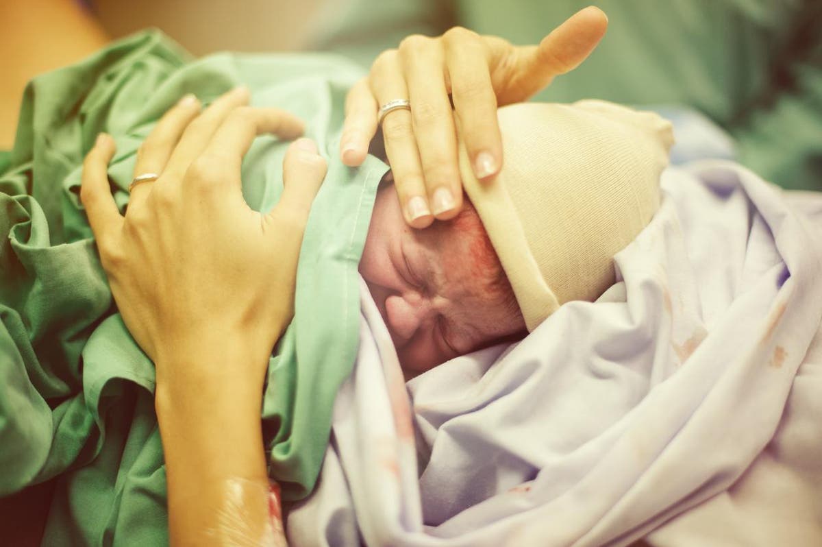 Having a &apos;natural&apos; C-section is better for baby and mum 