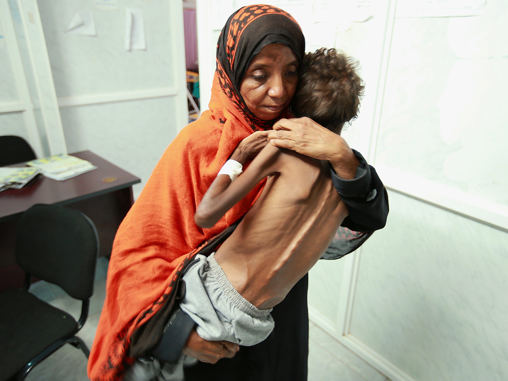 A woman carries her son Imran Faraj, 8 year-old, who is suffering from malnutrition at a hospital in the Red Sea port city of Hodeidah