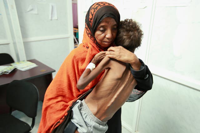 A woman carries her son Imran Faraj, 8 year-old, who is suffering from malnutrition at a hospital in the Red Sea port city of Hodeidah