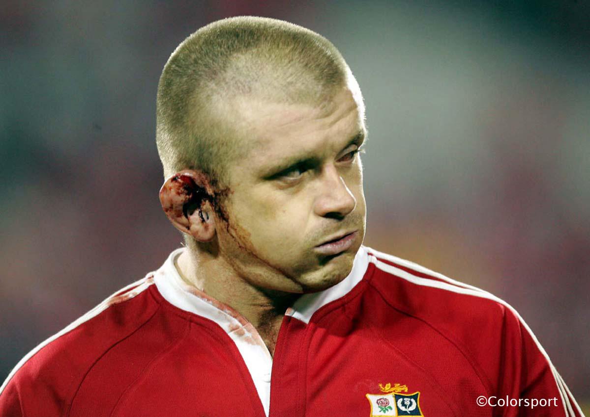 2005 | 3rd Test: NZ 38 Lions 19 | Lions prop Graham Rowntree sports a bloodied ear during another heavy defeat in the final test