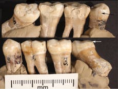 Neanderthal attempted dentistry 130,000 years ago, scientists believe