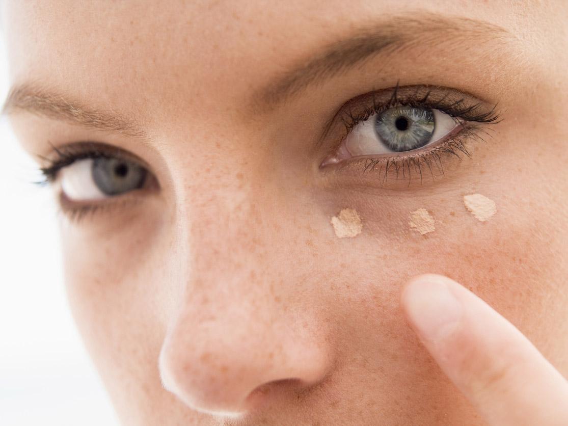 How to Get Rid of UnderEye Bags