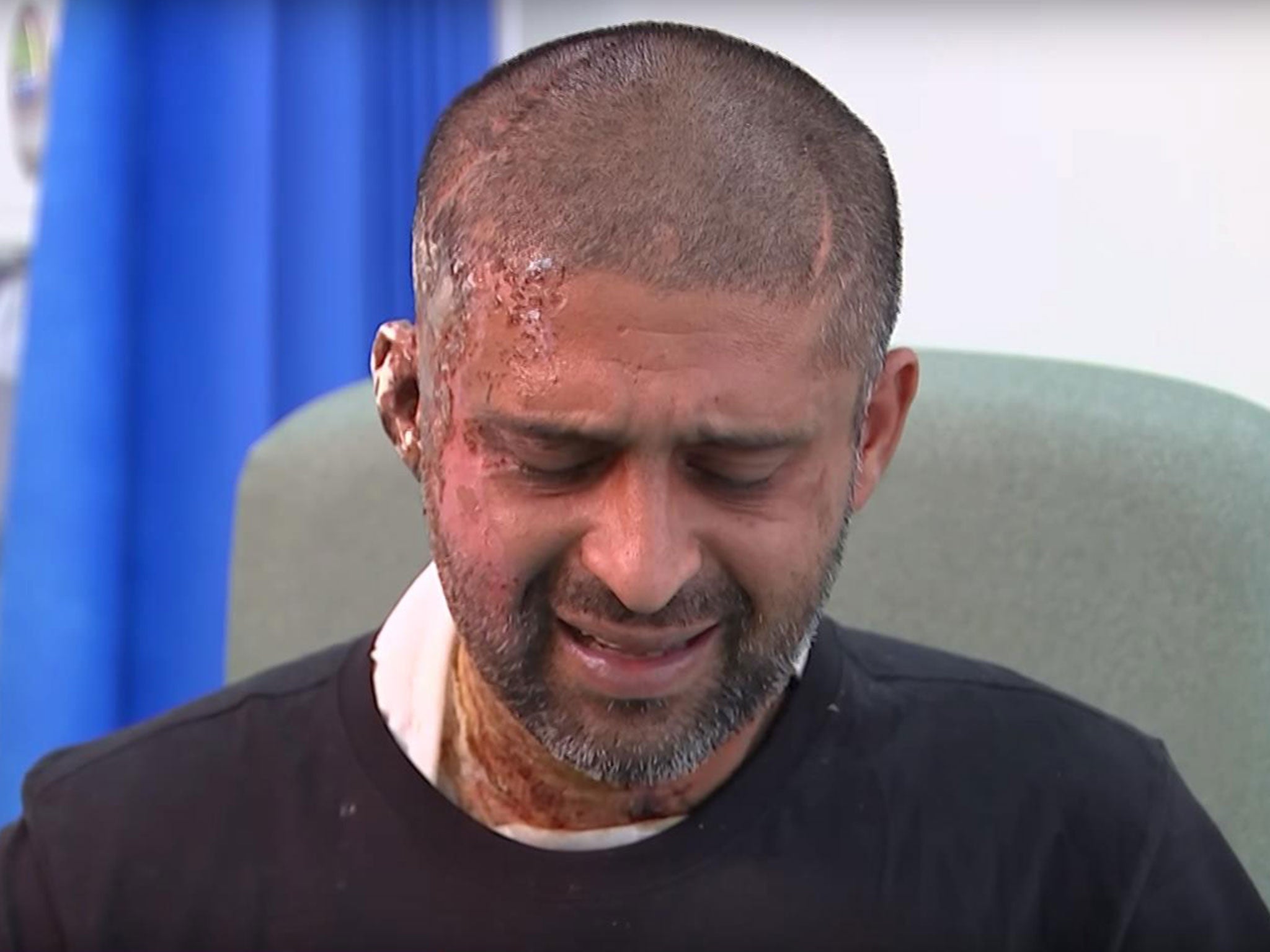 Jameel Muhktar, 37, in hospital following an acid attack on 21 June