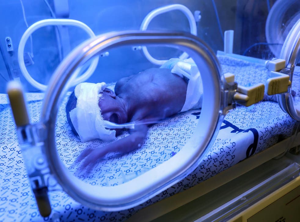 A newborn is seen inside an incubator at the neonatal intensive care unit at the UAE hospital in Rafah in the southern Gaza Strip on 27 June 2017