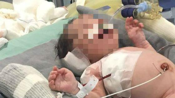 Baby Arthur's family members are praying for a full recovery