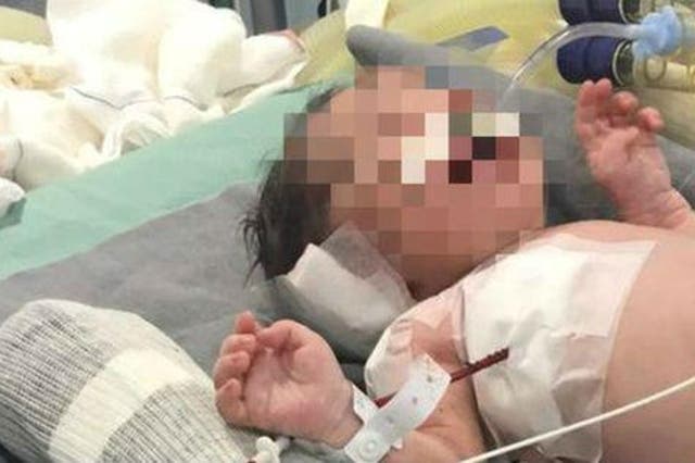 Baby Arthur's family members are praying for a full recovery