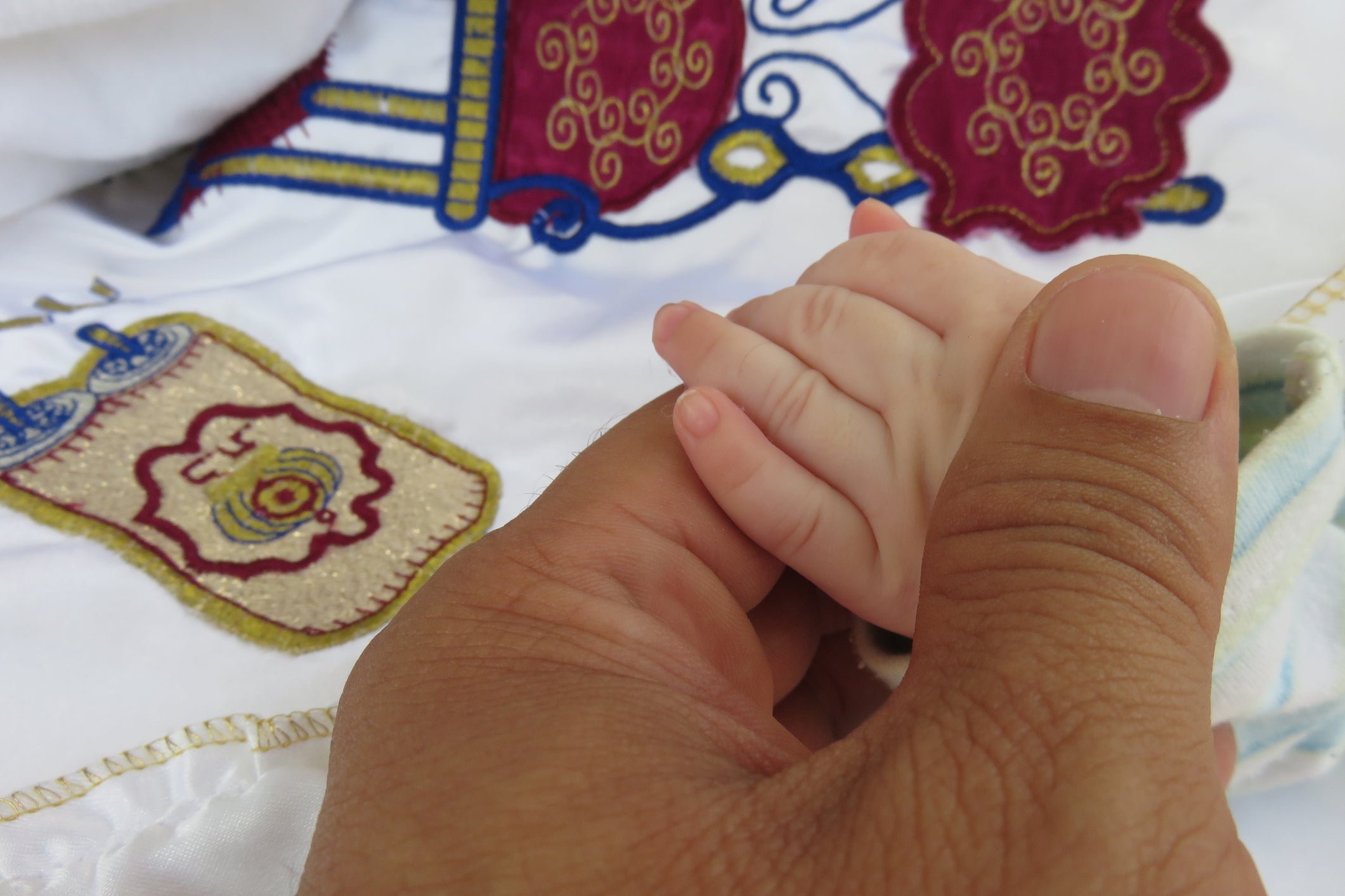 The reasons for circumcision are varied but are often religious or cultural