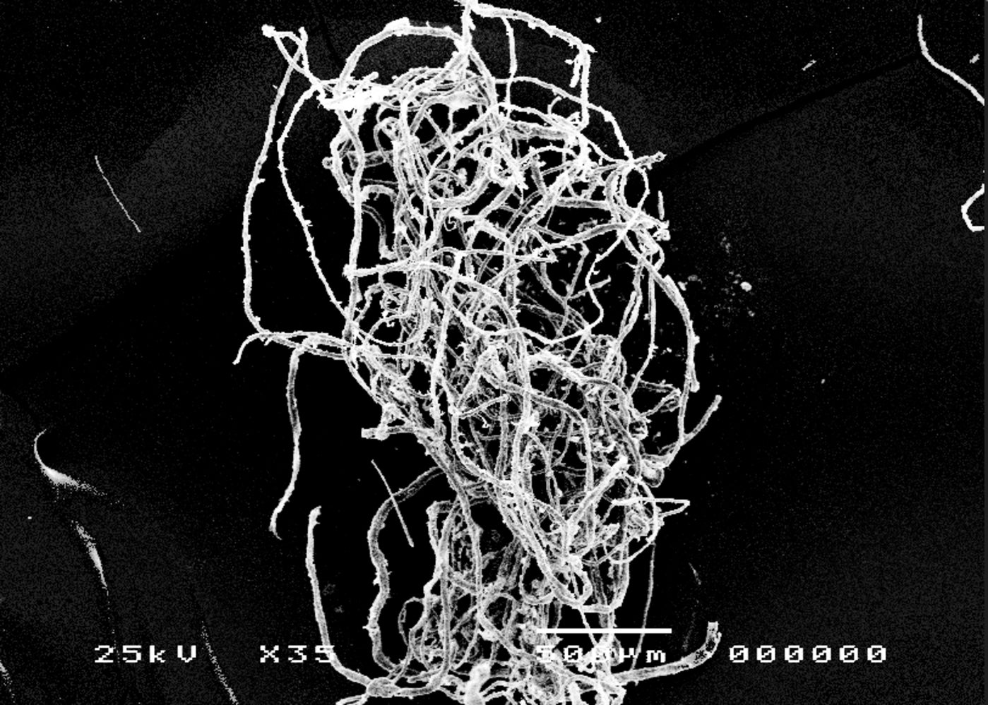 Electron microscope image of plastics recovered from stomachs of Scottish langoustine