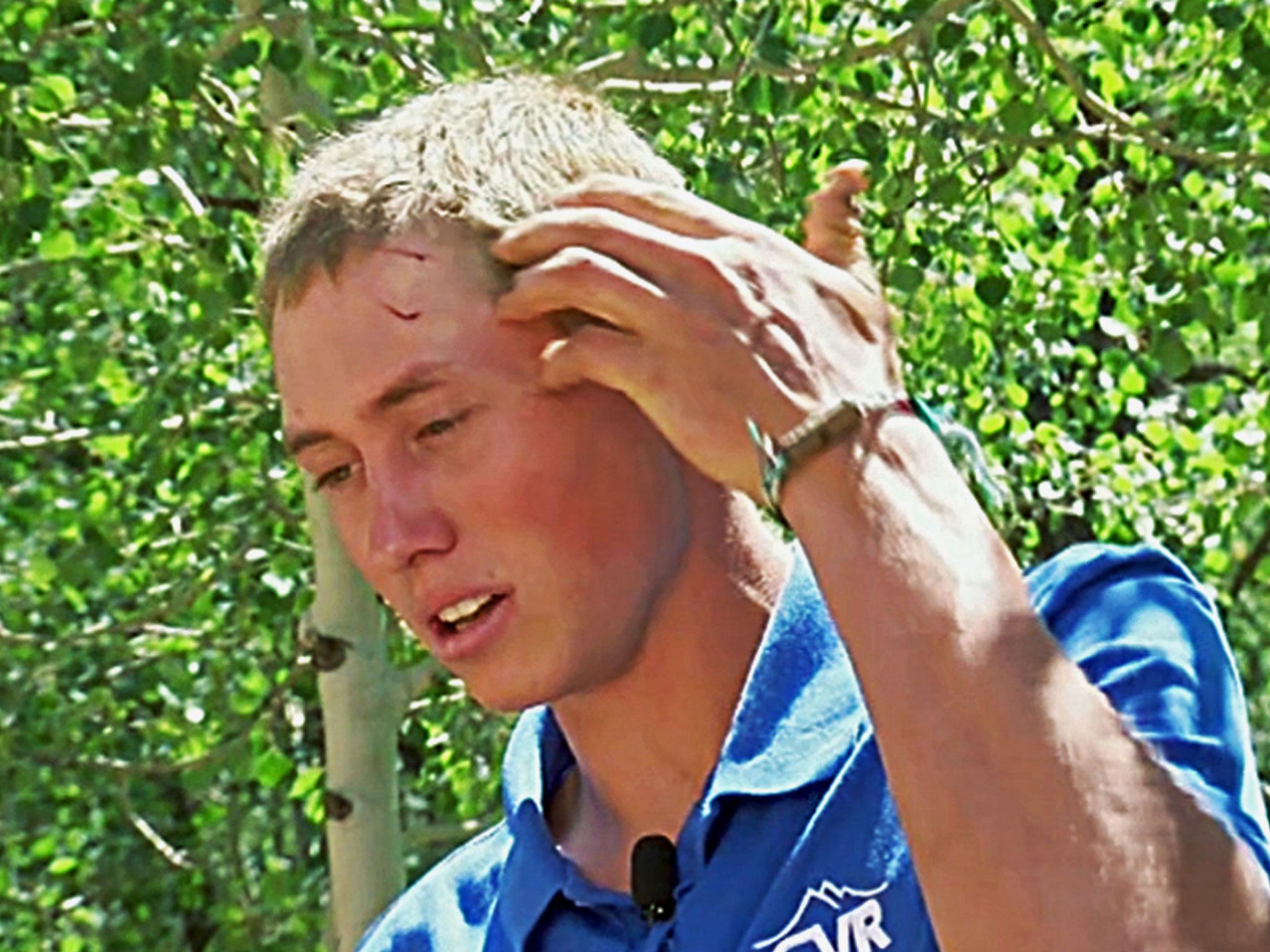 This still frame from video provided by KMGH-TV shows Dylan describing how he fought off a bear after waking up to find the animal biting his head and trying to drag him away