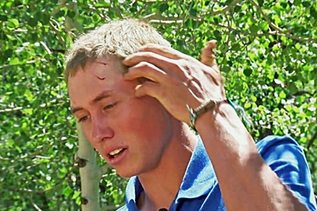This still frame from video provided by KMGH-TV shows Dylan describing how he fought off a bear after waking up to find the animal biting his head and trying to drag him away