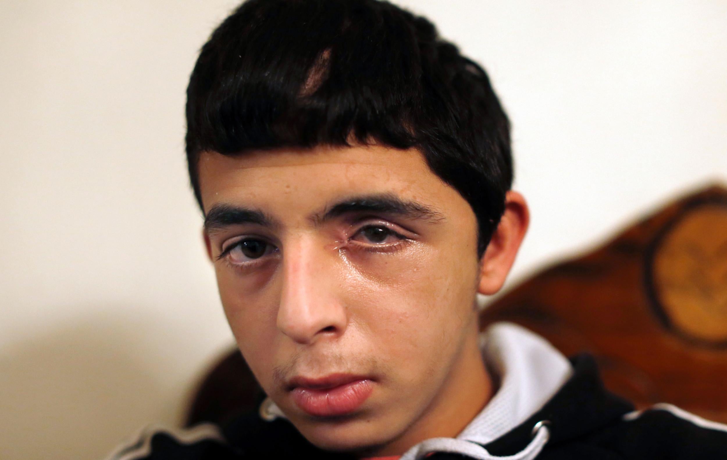 &#13;
Another victim: Khalil al-Kisuani, 15, lost his eye from a bullet last year &#13;