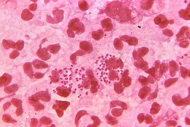 Gonorrhoea bacteria under the microscope, as the first vaccination shown to protect against the sexually transmitted infection has been developed by scientists