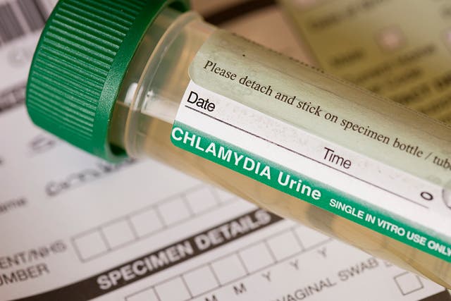 Chlamydia diagnoses are increasing at fastest rate since mid-20th century