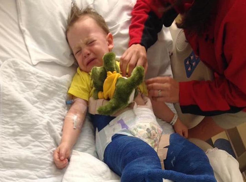 3-year-old Colton is now having to adjust to life in a cast which covers both legs for the next six weeks
