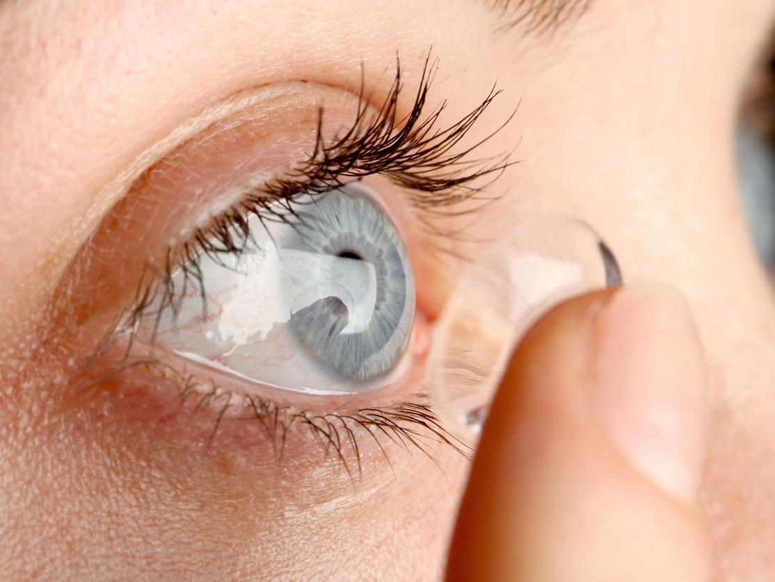 Kaal Meesterschap Scheermes Lost contact lens removed from woman's eye after 28 years | The Independent  | The Independent