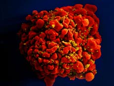 HIV breakthrough could lead to new treatment