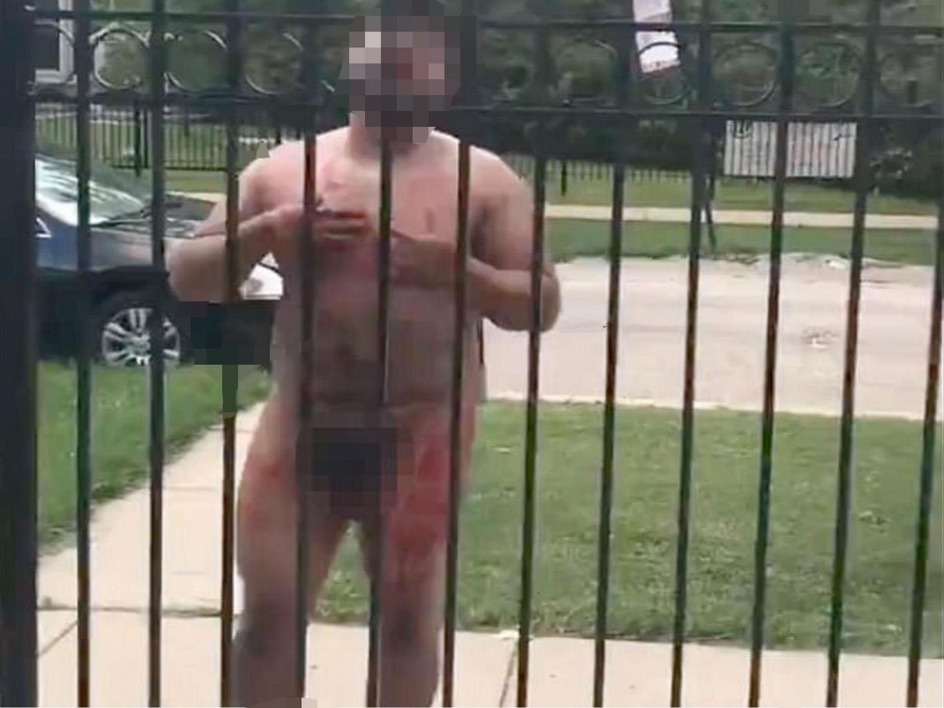 Naked man cuts off penis and goes on rampage in Chicago The Independent The Independent photo