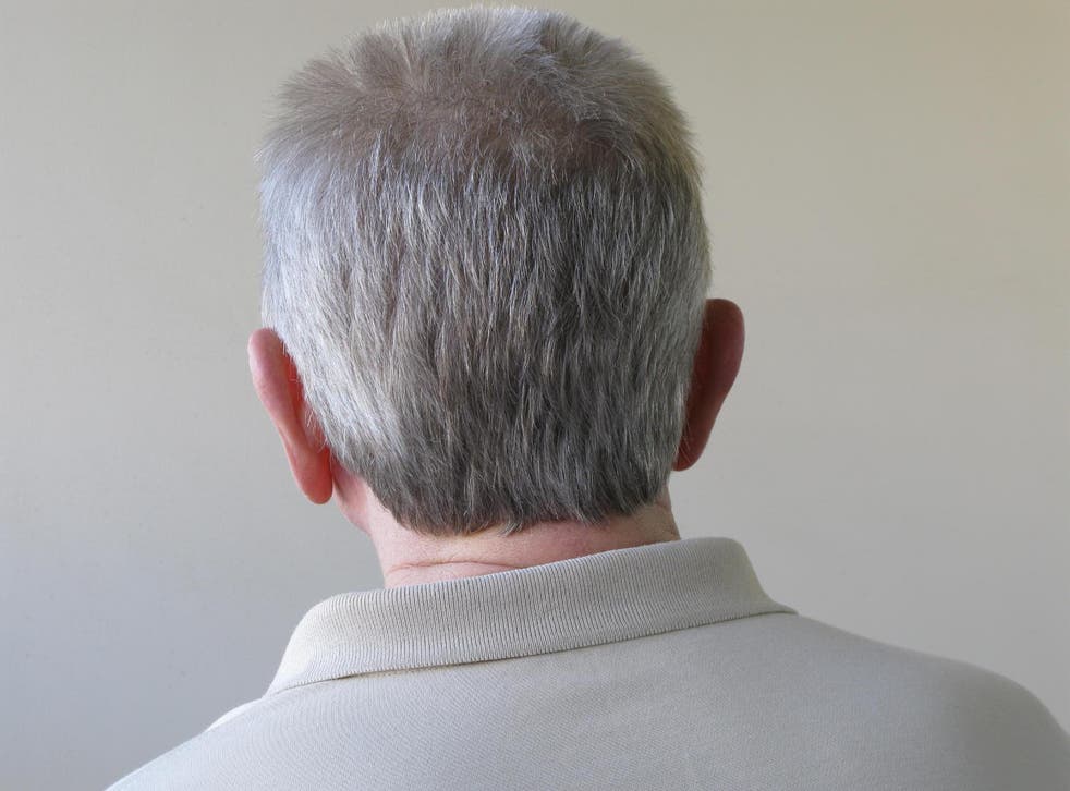 If confirmed, a new strain of the drug could be developed to treat grey hair