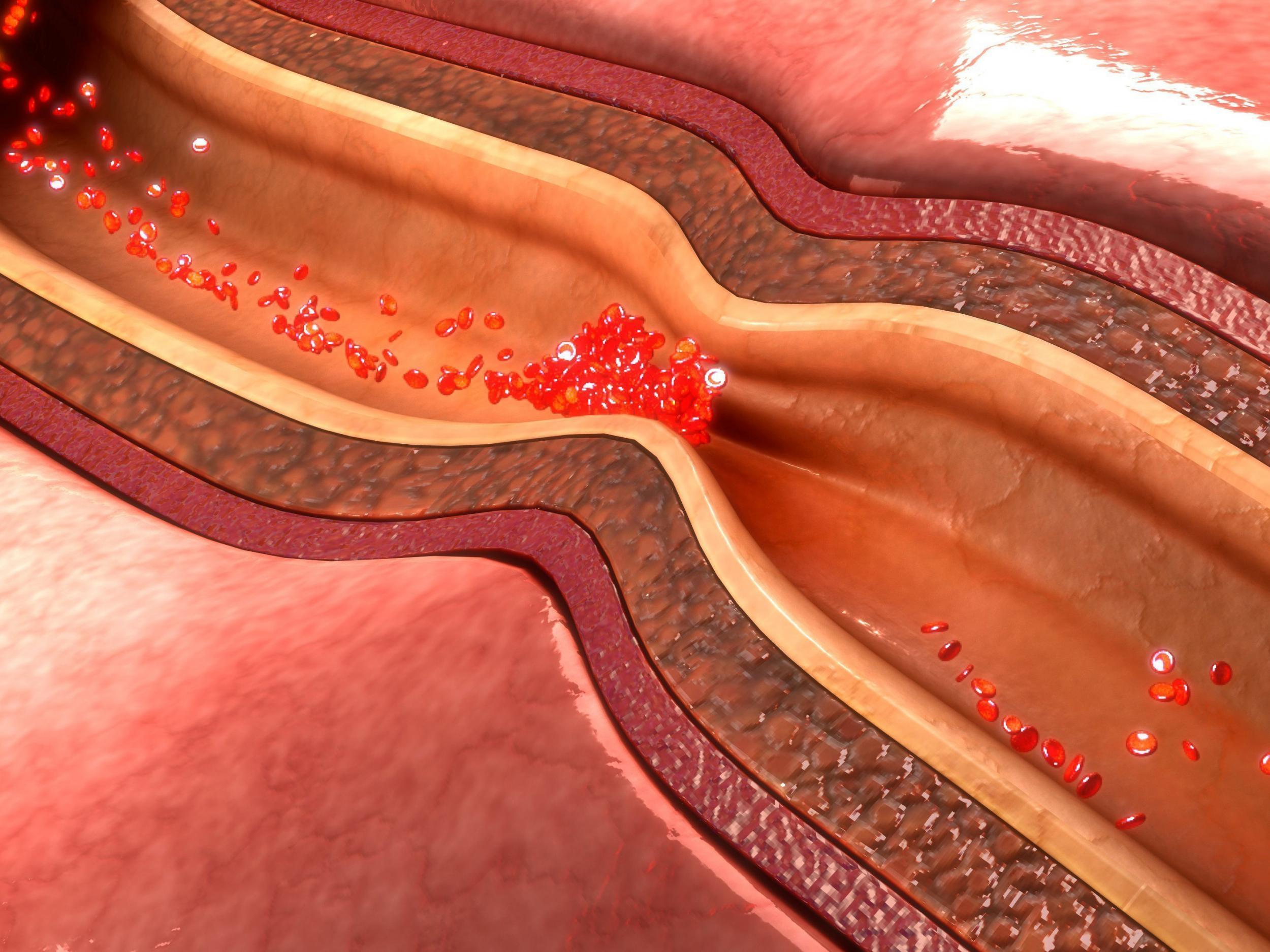 Расширение артериальных сосудов. Сужение кровеносных сосудов. Спазм венечных артерий.