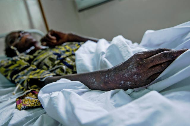 A patient is treated at the MSF HIV centre in the town of Lingala, Democratic Republic of Congo