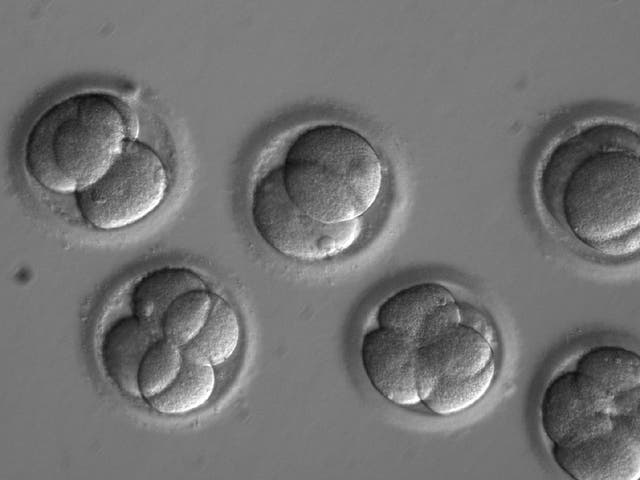 Human embryo editing breakthrough is a ‘major advance’ towards ...