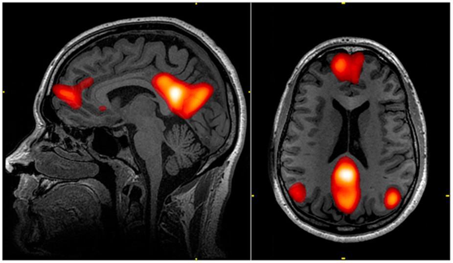 Functional magnetic resonance imaging could reveal whether someone knows something they're not telling