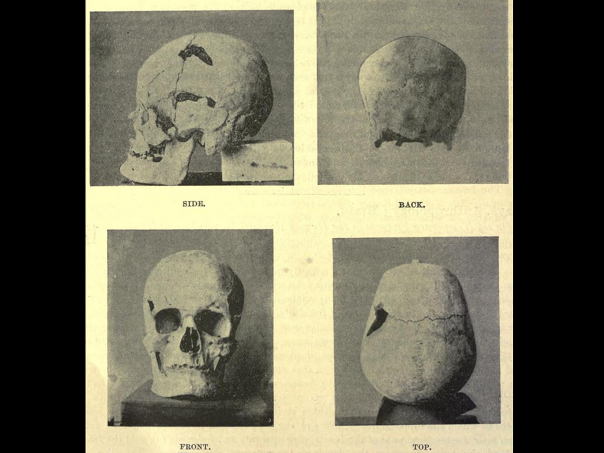 Images from 1901 of the skull that is believed to belong to Pharaoh Sanakht