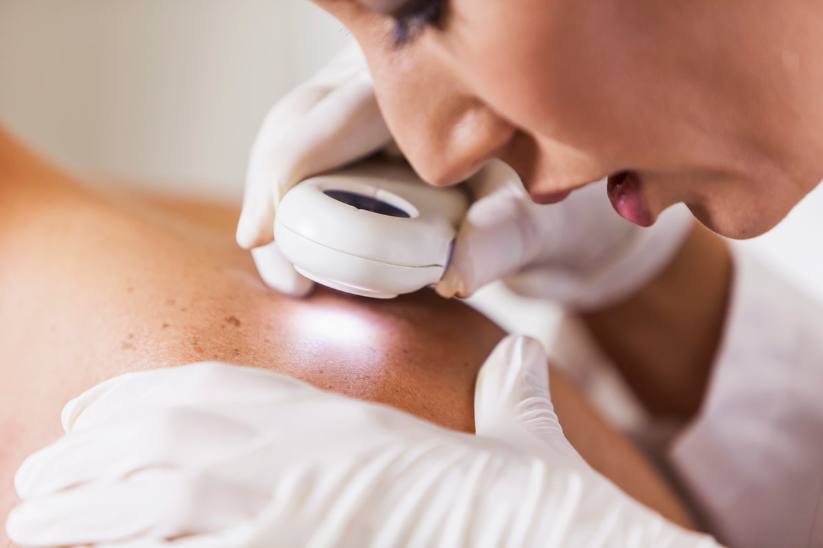 The over-the-counter medication which could help reduce risk of skin cancer