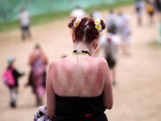 Warning issued after hundreds treated for sunburn during heatwave
